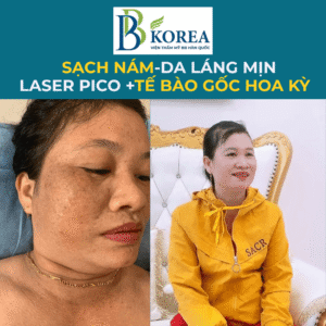  Điều trị nám lâu năm giúp da sáng đều màu hơn tại Đồng Xoài