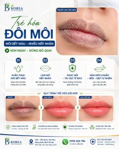 Hình ảnh trước và sau khử thâm môi giúp khách hàng dễ quan sát sự thay đổi của nền sắc tố môi.