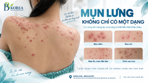 Mụn lưng viêm