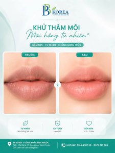 Môi thâm có nên phun môi ngay? Nền môi cần được kiểm tra trước để lựa chọn phương án và màu sắc phù hợp.