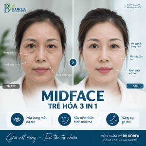Sau tuổi 40, một số chị em bắt đầu nhận thấy vùng dưới mắt, má và rãnh cười thay đổi rõ hơn.