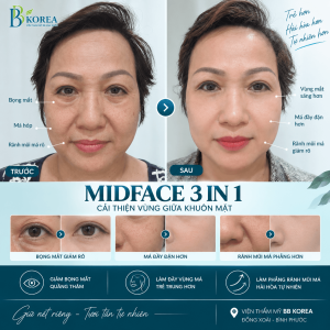 Đánh giá vùng Midface giúp xác định tình trạng thực tế trước khi lựa chọn hướng cải thiện phù hợp.