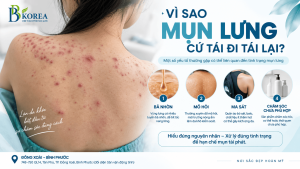Mụn lưng tái đi tái lại