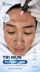 Trị mụn Plasma lạnh Đồng Xoài, Bình Phước tại BB KOREA. Tìm hiểu công nghệ Multiple Cold Plasma và cách chăm sóc da mụn phù hợp với từng tình trạng da.