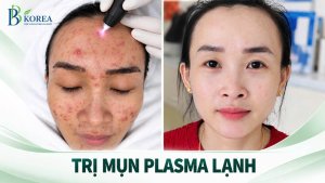 Tìm hiểu cách chăm sóc da thâm sau mụn và lựa chọn phương pháp phù hợp tại Đồng Xoài.