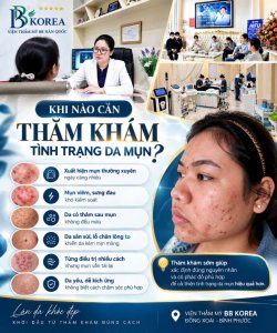 Dịch vụ chăm sóc da mụn tại BB KOREA – Đồng Xoài, Bình Phước.