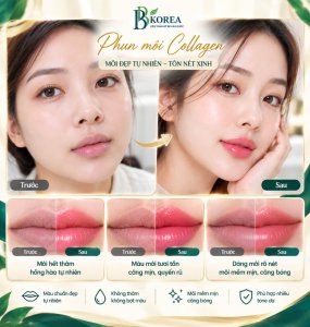 Dịch vụ phun môi Collagen tại Viện Thẩm Mỹ BB KOREA, Đồng Xoài, Bình Phước. Khách hàng được tư vấn màu môi phù hợp với nền môi và phong cách cá nhân.